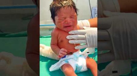 First Week Of Newborn#trendingshorts #medical #viralvideo