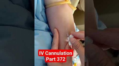 IV Cannulation | Part 372 | ICU #shorts #ivcannulation #viral #youtubeshorts #medical