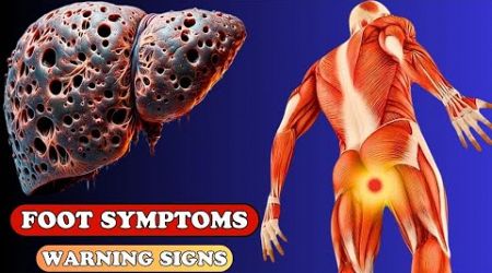 Warning Signs: 9 Unexpected Foot Symptoms of Liver Damage | Health care