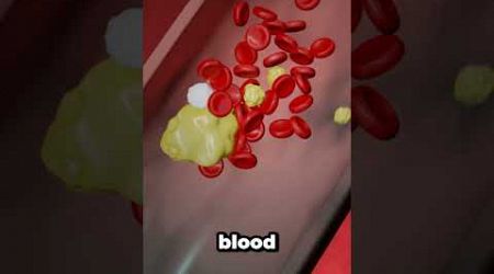 How a blood clot actually causes a heart attack? #Medical #animation #heartattack