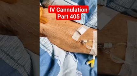 IV Cannulation | Part 405 | Medical #shorts #viral #youtubeshorts