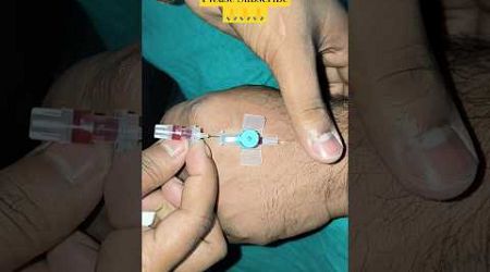 IV cannula technique IV cannula kaise lagate hain #bscnurcing #nursingh #medical#cannula #vigo #bams