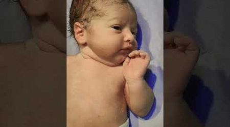 baby smile after birth #nicubaby #cutebaby #childbirth #medical #babyshorts #youtubeshorts #tranding