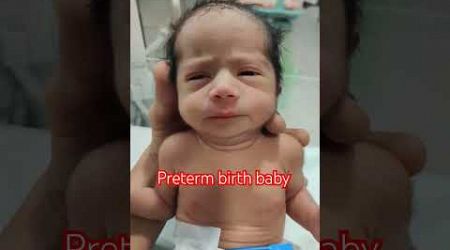 preterm birth baby girl 
