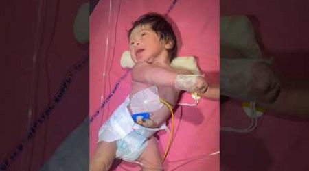 Newborn Convulsions#baby #medical #viral