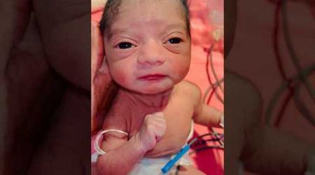 Premature Newborn #nicu #medical #viral
