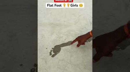 Flat Foot 