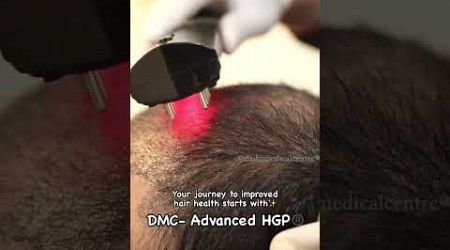 Say Goodbye to Excess DTH Hormones | Hair Transplant Clinic | Dadu Medical Centre