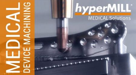 hyperMILL MEDICAL Solutions: Produzir produtos médicos com sucesso