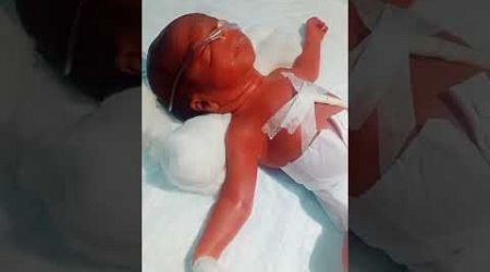 Newborn Baby After Birth