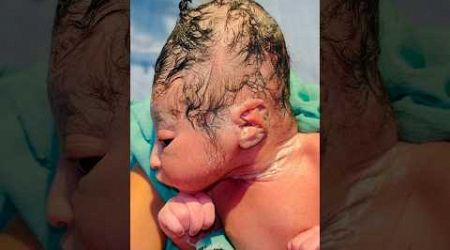 Look Different Newborn #nicu #baby #medical #viral