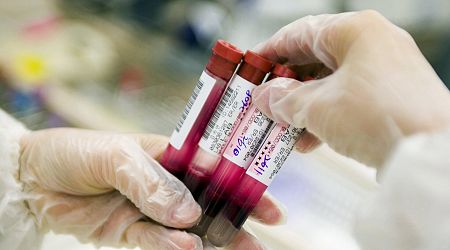 Blood Test Shows Promise for Alzheimer’s Diagnosis