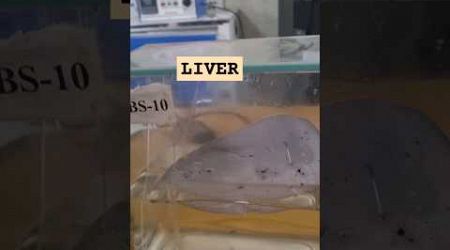 Human Liver in Medical college #neet #aspirant #mbbs #govtmedicalcollege #neetmotivation #shorts