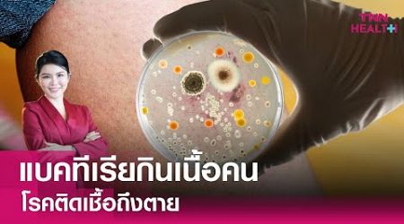 “แบคทีเรียกินเนื้อคน” โรคติดเชื้อถึงตาย : TNN Health