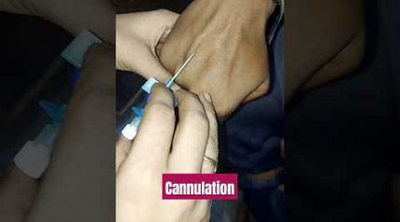 #iv #injective #injection #viralvideo #shortsvideo #short #trending #trends #latest #ivinjection