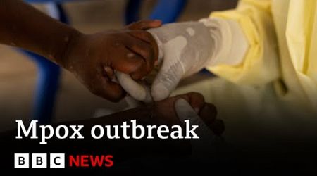 Mpox declared public health emergency in Africa | BBC News