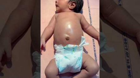 Newborn Abdominal Distension #nicu #newbornbaby #medical