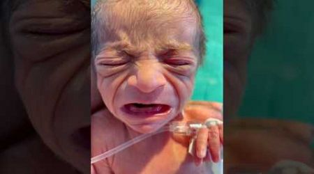 Premature Baby video #nicu #medical