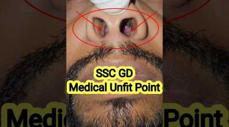 SSC GD Medical Unfit Point | CRPF Recruitment | #shorts #sscgd #bsf #crpf