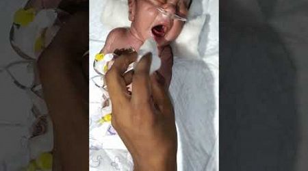 nicu new born baby after moment 