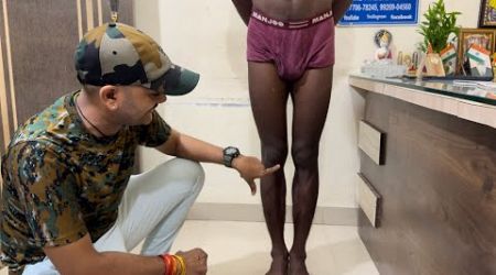 Indian Army GD Medical Test की पूरी जानकारी! # Knock Knee ऐसे Check करते है!