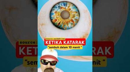 KETIKA KATARAK!! Disembuhkan dengan operasi #science #mrbeast #education #physics @zackdfilms