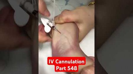 IV Cannulation | Part 548 | NICU #shorts #ivcannulation #youtubeshorts #nursery #medical #hospital