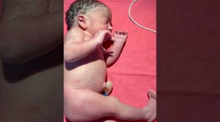 Just Birth#medical #newbornbaby #viralvideo