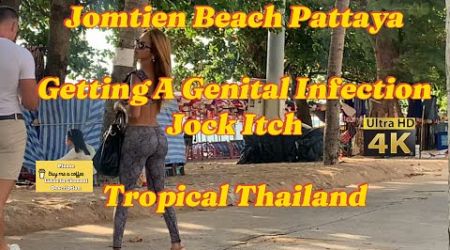 When You Get A Genital Sexual ,Fungal Infection In Pattaya Thailand | Scrotum Eczema …Be Careful