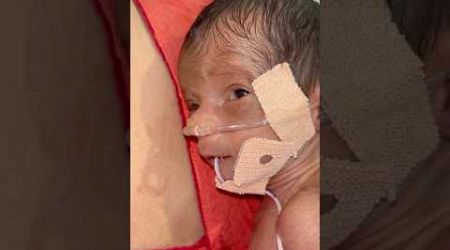 Emotional Video #medical #newbornbaby #viralvideo