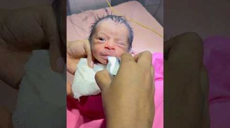 Very Cute Little Baby Feeding #medical #newbornbaby #viralvideo