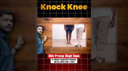 Knock Knee Problem in Army Medical 