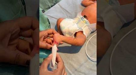 Wound Repair #medical #newbornbaby #viralvideo