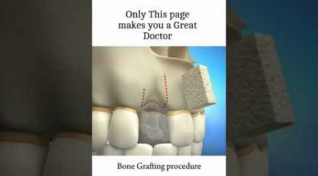 Bone Grafting Procedure #medical #doctor #neet #biology #dentist