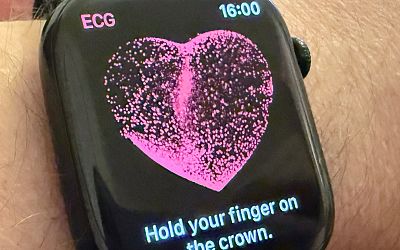 Apple Watch & Apple Vision Pro fabrics may get embedded medical sensors