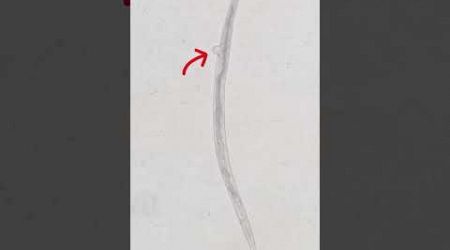 Pineapple Juice vs Parasites #health #microscope #viralshorts #fyp