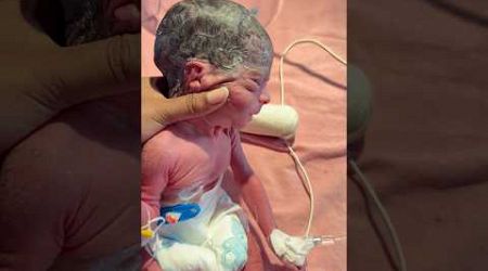 Different Types Head#medical #newbornbaby #viralvideo