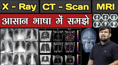 X - Ray | CT - scan | MRI | Chest X ray | Doctor | BHMS | BAMS | BUMS | MBBS | Nursing | Pharmacy