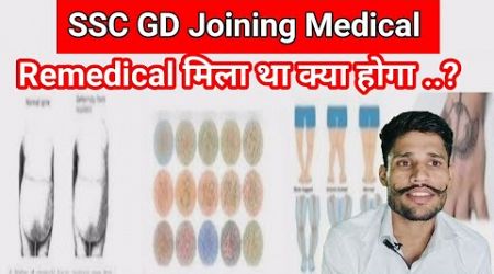 SSC GD Joining Medical ।। Remedical मिला था क्या होगा ..?