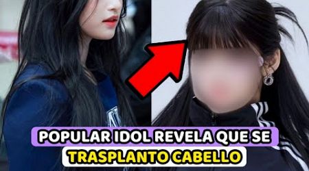 POPULAR IDOL REVELA ABIERTAMENTE QUE SE TRASPLANTO CABELLO