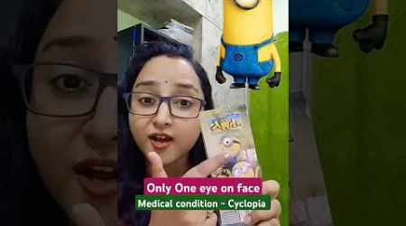 One Eye on Face- Cyclopia medical condition. #cyclopia #shorts #jyotikumari #teachingpathshala #csir