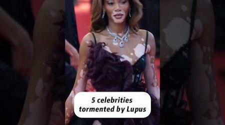 5 celebrities tormented by lupus #celebrity #entertainment #star #actor #hollywood