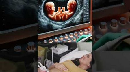 Twins Sharing Space Captured in a Pregnancy Ultrasound | A Glimpse of Life Before Birth #life #short