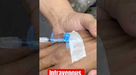 Intravenous Cannulation || Cannulation #trending #shorts #medicalequipment #medicine #medicine