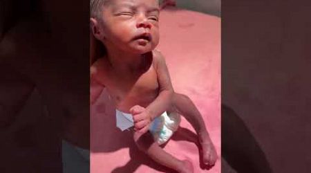 Newborn baby showing#medical #viralvideo