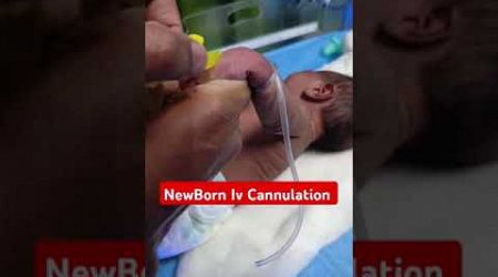 NewBorn Iv Cannulation ll Medical Motivational Short&#39;s ll #newbornbaby #ivcannulation