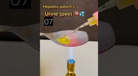 Urine 