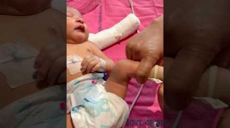 Trying For Iv Cannula #medical #newbornbaby #viralvideo