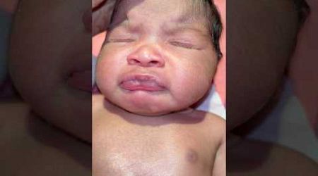 Cute Crying #cutebaby #medical #viralvideo