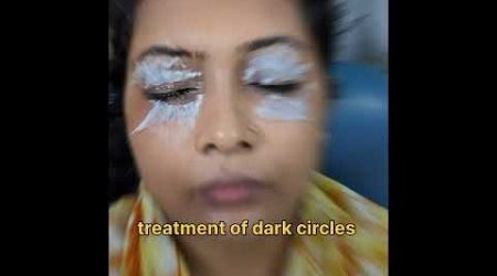 Smt.Anuradha Under eye dark circles treatment #medical #doctor #skincare